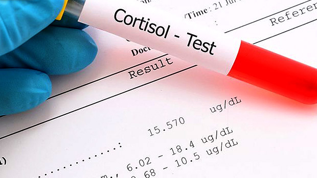 The-Truth-About-Cortisol